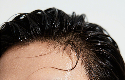 治头发出油的小偏方